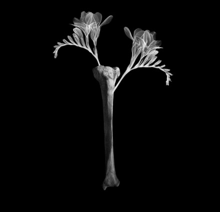 La flor de la tibia, 2008. Carbón siberiano sobre papel Arches. 100 x 100 cm